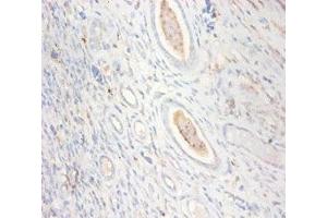 Immunohistochemistry of paraffin-embedded human kidney tissue using ABIN7148667 at dilution of 1:100 (CKMT1A anticorps  (AA 40-417))