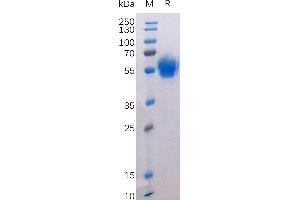 Human BTLA Protein, hFc Tag on SDS-PAGE under reducing condition.