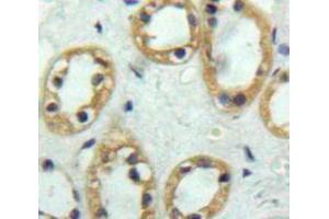 Used in DAB staining on fromalin fixed paraffin-embedded Kidney tissue