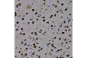 Immunohistochemistry of paraffin-embedded mouse brain using MEF2C antibody at dilution of 1:200 (400x lens). (MEF2C anticorps)