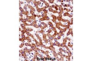 Immunohistochemistry (IHC) image for anti-Indian Hedgehog (IHH) antibody (ABIN2998360)