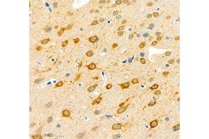 Immunohistochemistry of paraffin embedded rat brain using NECAB1 (ABIN7074753) at dilution of 1: 5000 (400x lens) (NECAB1 anticorps)