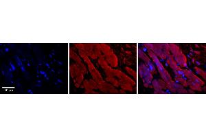 Rabbit Anti-ENO1 Antibody    Formalin Fixed Paraffin Embedded Tissue: Human Adult heart  Observed Staining: Cytoplasmic,Membrane Primary Antibody Concentration: 1:100 Secondary Antibody: Donkey anti-Rabbit-Cy2/3 Secondary Antibody Concentration: 1:200 Magnification: 20X Exposure Time: 0.