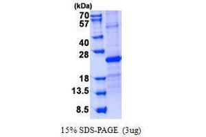 Figure annotation denotes ug of protein loaded and % gel used. (SOSTDC1 Protéine)