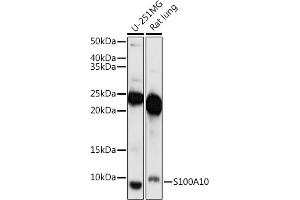Western blot analysis of extracts of various cell lines, using S100 antibody (ABIN7270123) at 1:1000 dilution. (S100A10 anticorps  (AA 1-97))