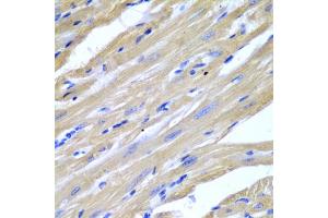 Immunohistochemistry of paraffin-embedded mouse heart using HSPB2 antibody (ABIN5971309) at dilution of 1/200 (40x lens). (HSPB2 anticorps)