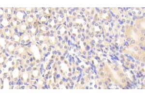 Detection of LTA4H in Mouse Kidney Tissue using Polyclonal Antibody to Leukotriene A4 Hydrolase (LTA4H)