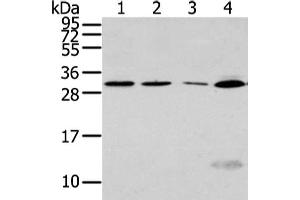 Gel: 12 % SDS-PAGE, Lysate: 40 μg, Lane 1-4: Hela, Jurkat and hepg2 cell, human fetal liver tissue, Primary antibody: ABIN7128017(SIAH1 Antibody) at dilution 1/300 dilution, Secondary antibody: Goat anti rabbit IgG at 1/8000 dilution, Exposure time: 1 minute (SIAH1 anticorps)