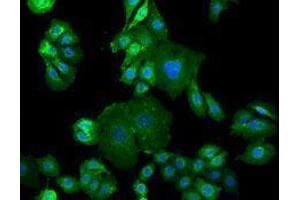 Immunofluorescence (IF) image for anti-Epidermal Growth Factor Receptor (EGFR) antibody (Alexa Fluor 488) (ABIN2657498) (EGFR anticorps  (Alexa Fluor 488))