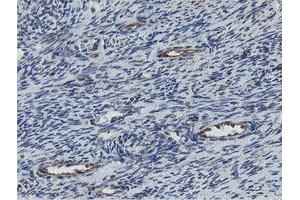 Image no. 2 for anti-Mitochondrial Ribosomal Protein S27 (MRPS27) (AA 151-414) antibody (ABIN1490969)