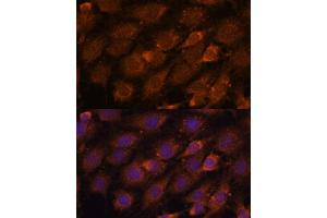Immunofluorescence analysis of C6 cells using CREB3 antibody (ABIN6128862, ABIN6139013, ABIN6139015 and ABIN6222241) at dilution of 1:100.