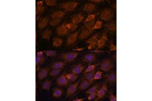 Immunofluorescence analysis of C6 cells using CREB3 antibody (ABIN6128862, ABIN6139013, ABIN6139015 and ABIN6222241) at dilution of 1:100. (CREB3 anticorps  (AA 1-230))