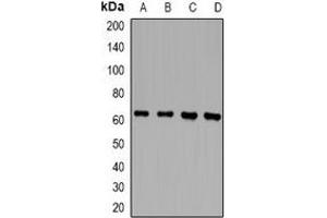 Western blot analysis of RLK expression in Jurkat (A), THP1 (B), mouse spleen (C), rat spleen (D) whole cell lysates.