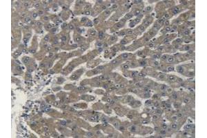 IHC-P analysis of Human Liver Tissue, with DAB staining. (Apolipoprotein L 2 anticorps  (AA 186-337))