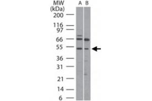 Western blot analysis of RUNX1 in (A) human Ramos and (B) mouse Raw cell lysate using RUNX1 polyclonal antibody  at 5 ug/mL . (RUNX1 anticorps  (AA 231-245))