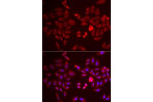 Immunofluorescence analysis of U2OS cells using PDK4 antibody (ABIN5971569). (PDK4 anticorps)