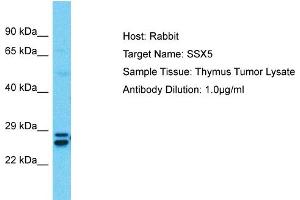 Host:  Rabbit  Target Name:  SSX5  Sample Type:  Thymus Tumor lysates  Antibody Dilution:  1. (SSX5 anticorps  (C-Term))