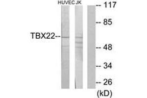 Western blot analysis of extracts from Jurkat/HuvEc cells, using TBX22 Antibody. (T-Box 22 anticorps  (AA 1-50))