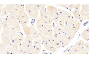 Detection of CST6 in Human Cardiac Muscle Tissue using Polyclonal Antibody to Cystatin 6 (CST6)