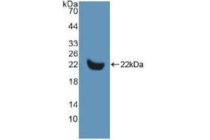 Detection of Recombinant MMP13, Human using Polyclonal Antibody to Matrix Metalloproteinase 13 (MMP13) (MMP13 anticorps  (AA 290-468))