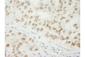 anti-Activity-Dependent Neuroprotector Homeobox (ADNP) (C-Term) antibody