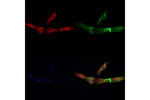 C1orf163 Antibody staining Hela cells by IF/ICC. (C1orf163 anticorps  (Internal Region))