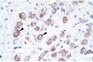 Immunohistochemical staining (Formalin-fixed paraffin-embedded sections) of human brain with LARP1 polyclonal antibody . (LARP1 anticorps  (AA 701-750))