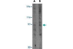 Western blot analysis of GRIK3 in human brain tissue lysate with GRIK3 polyclonal antibody  at (A) 1 and (B) 2 ug/mL . (GRIK3 anticorps  (N-Term))