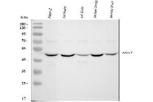 Western blot analysis of ABAT using anti-ABAT antibody (ABIN4886408).