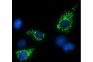 Image no. 3 for anti-tRNA 5-Methylaminomethyl-2-Thiouridylate Methyltransferase (TRMU) antibody (ABIN1501523)