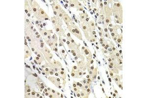 Immunohistochemistry of paraffin-embedded human stomach using SOX5 antibody.
