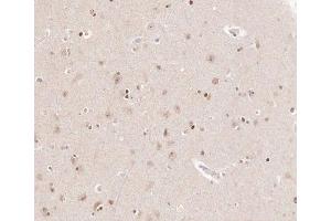 ABIN6266905 at 1/100 staining human brain tissue sections by IHC-P.