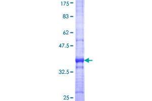 Image no. 1 for Monooxygenase, DBH-Like 1 (MOXD1) (AA 21-120) protein (GST tag) (ABIN1311187)