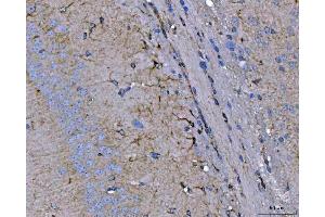 IHC analysis of Septin 2/SEPTIN2 using anti-Septin 2/SEPTIN2 antibody (ABIN7599275). (Septin 2 anticorps  (AA 1-326))