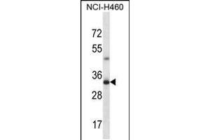 Western blot analysis in NCI-H460 cell line lysates (35ug/lane). (TBC1D21 anticorps  (N-Term))