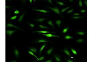 Immunofluorescence of monoclonal antibody to GTF2IRD1 on HeLa cell.