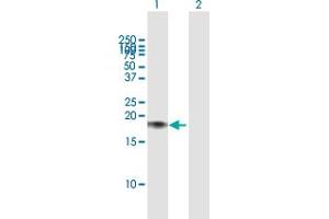 Western Blot analysis of CALM2 expression in transfected 293T cell line by CALM2 MaxPab polyclonal antibody. (Calmodulin 2 anticorps  (AA 1-149))