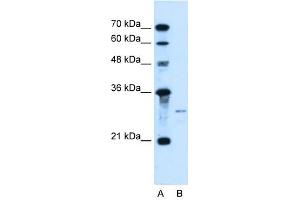 Sonic Hedgehog antibody used at 1 ug/ml to detect target protein.