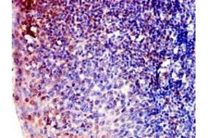 Immunohistochemistry of paraffin-embedded human tonsil tissue using ABIN7143081 at dilution of 1:100 (ARPC1B anticorps  (AA 16-316))