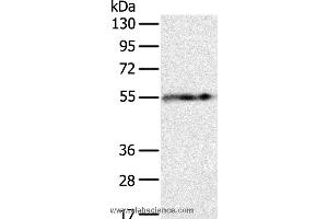 Western blot analysis of Human fat tissue, using PLIN1 Polyclonal Antibody at dilution of 1:250 (PLIN1 anticorps)