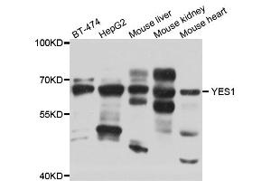 Western blot analysis of extracts of various cell lines, using YES1 antibody (ABIN5974700) at 1/1000 dilution. (YES1 anticorps)