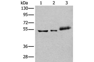 Western blot analysis of Hela cell Mouse kidney tissue and Human colorectal cancer tissue lysates using YY2 Polyclonal Antibody at dilution of 1:800 (YY2 anticorps)