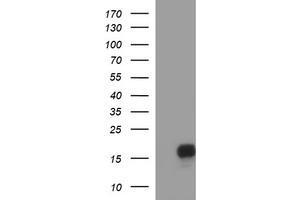 Image no. 1 for anti-SIVA1, Apoptosis-Inducing Factor (SIVA1) antibody (ABIN1500939) (SIVA1 anticorps)