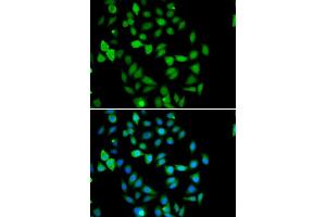 Immunofluorescence analysis of U20S cell using STAMBP antibody. (STAMBP anticorps)
