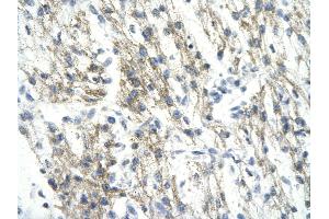 Rabbit Anti-RUVBL1 antibody   Paraffin Embedded Tissue: Human Heart cell Cellular Data: cardiac cell of renal tubule Antibody Concentration: 4.