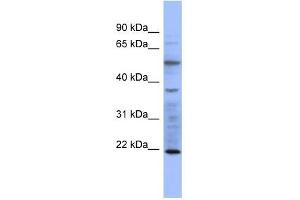 MYL3 antibody used at 1 ug/ml to detect target protein. (MYL3/CMLC1 anticorps  (N-Term))