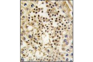 Immunohistochemistry (IHC) image for anti-Lin-28 Homolog A (C. Elegans) (LIN28A) antibody (ABIN356385)
