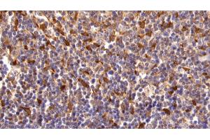 Detection of TGM2 in Human Lymph node Tissue using Polyclonal Antibody to Transglutaminase 2 (TGM2)