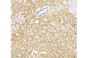 Immunohistochemistry analysis of paraffin-embedded mouse spinal cord using,KCC2 (ABIN7075650) at dilution of 1: 1800