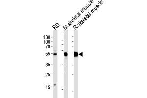 Western Blotting (WB) image for anti-Enolase 3 (Beta, Muscle) (ENO3) antibody (ABIN3001691) (ENO3 anticorps)